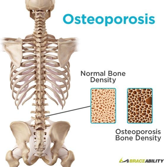 8-week Osteoporosis and Fibromyalgia focused exercise program